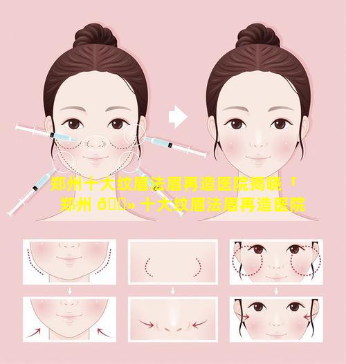 郑州十大纹眉法眉再造医院揭晓「郑州 🌻 十大纹眉法眉再造医院揭晓医生」